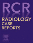 مجله علمی  گزارش‌های موردی رادیولوژی 