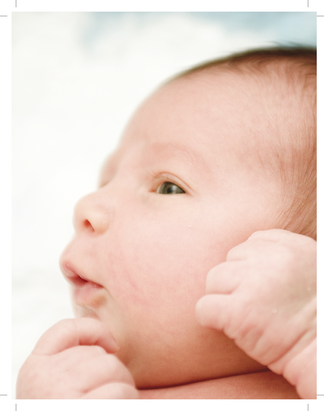 Physical Assessment of the Newborn: Minor Congenital Anomalies