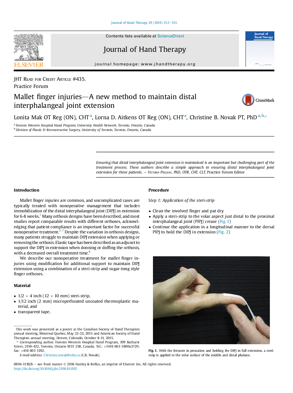 آسیب های انگشت چکشی: یک روش جدید برای حفظ اکستنشن مشترک اینترفاالنژیال دیستال
