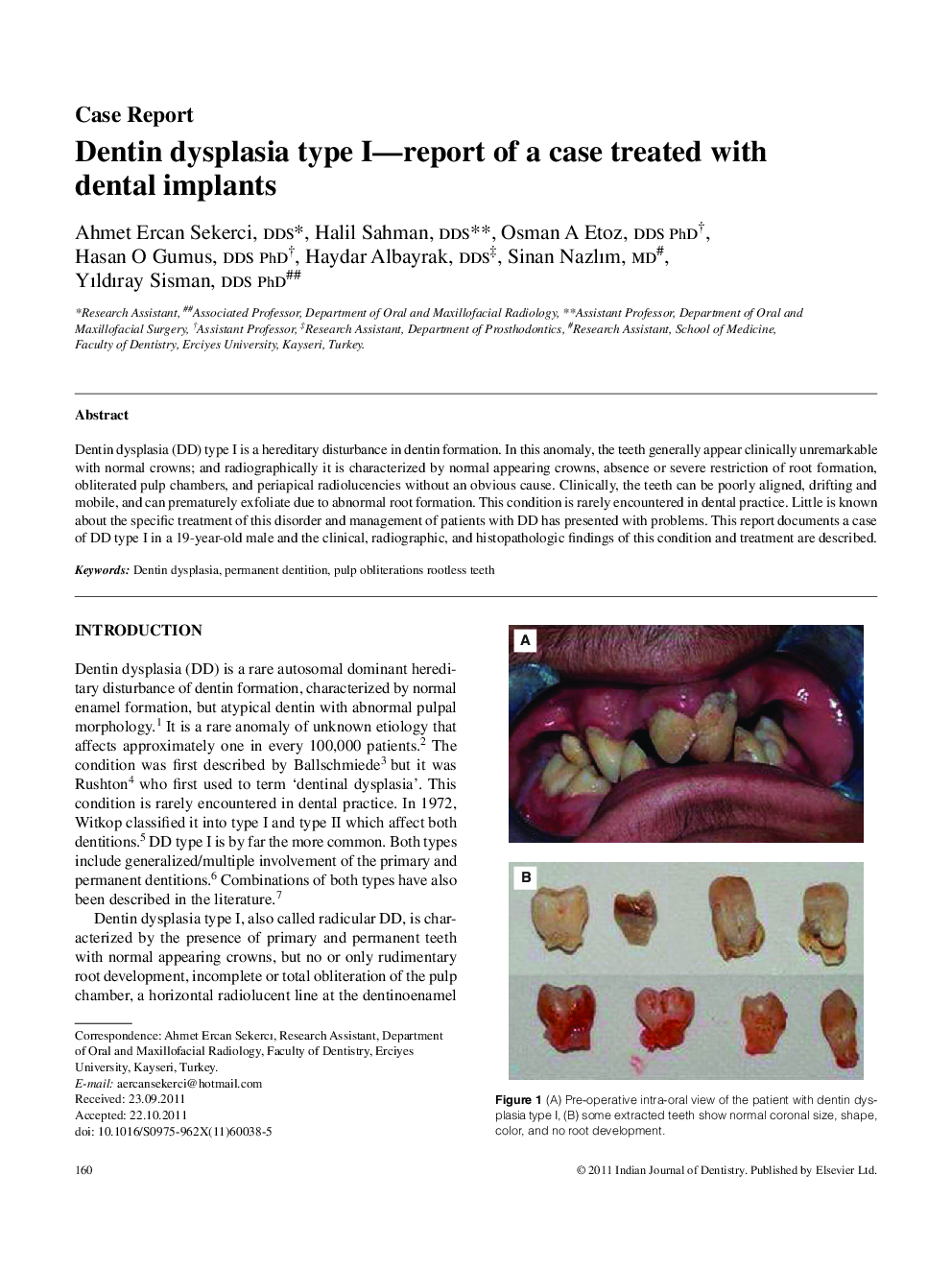 Dentin dysplasia type I-report of a case treated with dental implants
