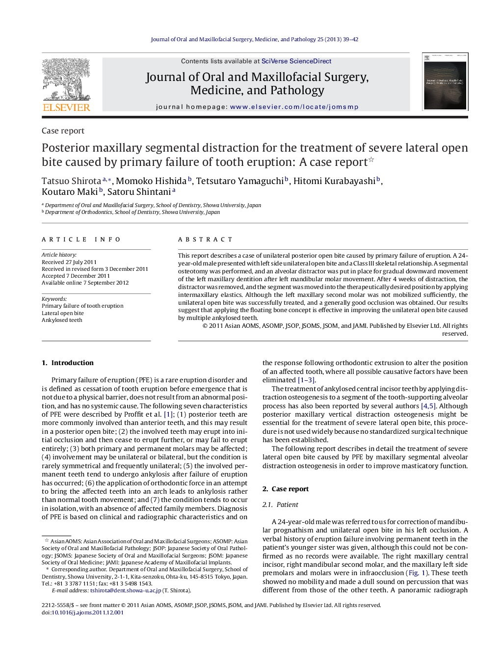 Posterior maxillary segmental distraction for the treatment of severe lateral open bite caused by primary failure of tooth eruption: A case report 