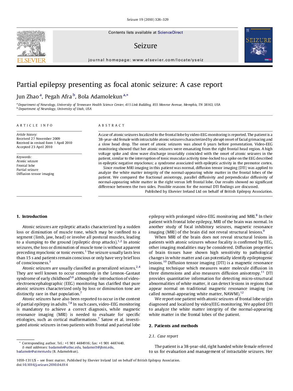 Partial epilepsy presenting as focal atonic seizure: A case report