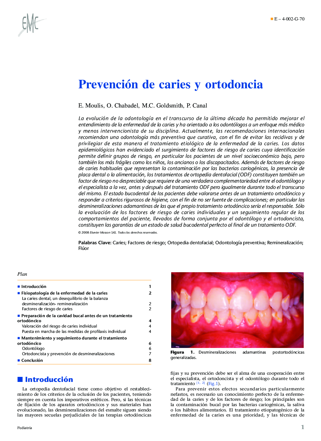 Prevención de caries y ortodoncia