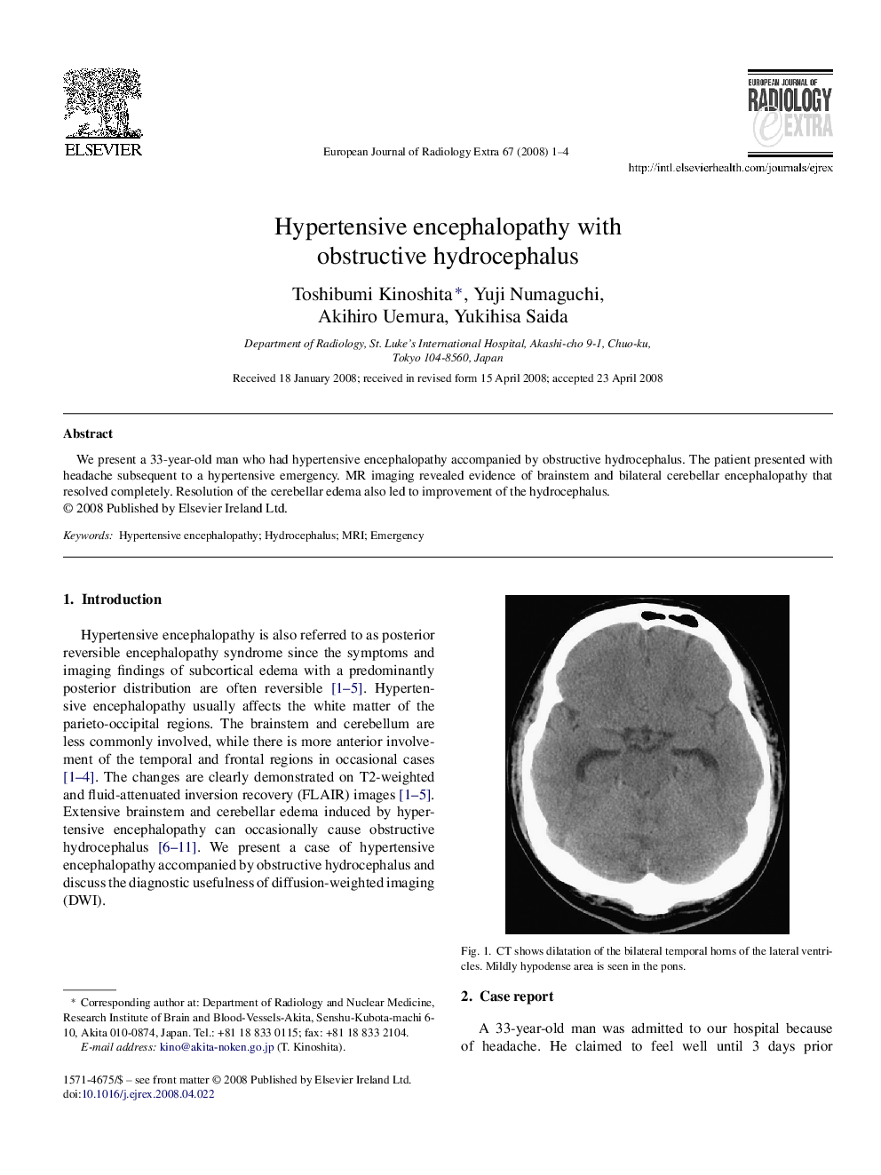 Hypertensive encephalopathy with obstructive hydrocephalus