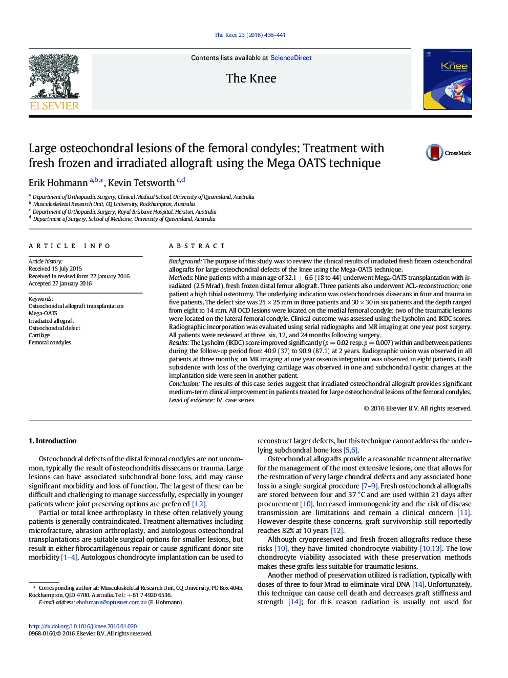 Large osteochondral lesions of the femoral condyles: Treatment with fresh frozen and irradiated allograft using the Mega OATS technique