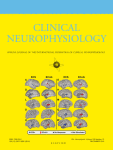 Journal: Clinical Neurophysiology