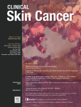 مجله علمی  سرطان پوست بالینی