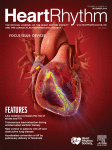 مجله علمی  ریتم قلب