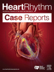 Journal: HeartRhythm Case Reports