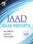 Journal: JAAD Case Reports