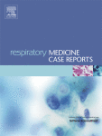 مجله علمی  گزارش‌های موردی پزشکی تنفسی 