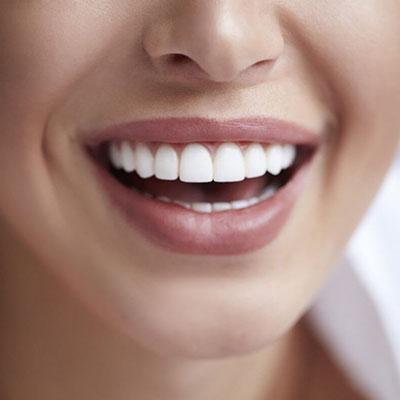انواع کامپوزیت دندان موجود در دندان پزشکی ها