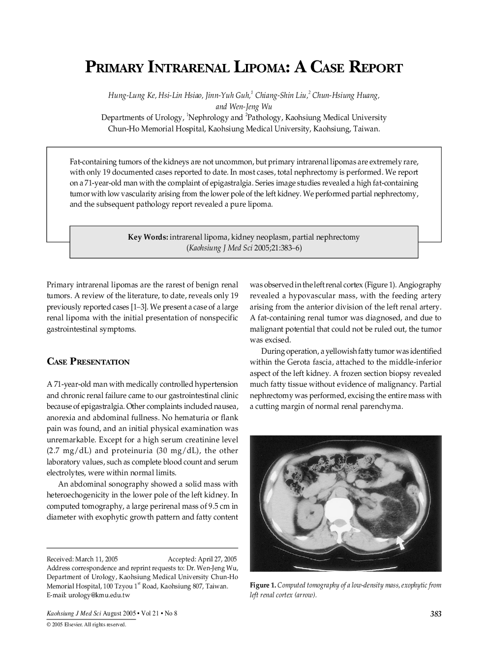 Primary Intrarenal Lipoma: A Case Report