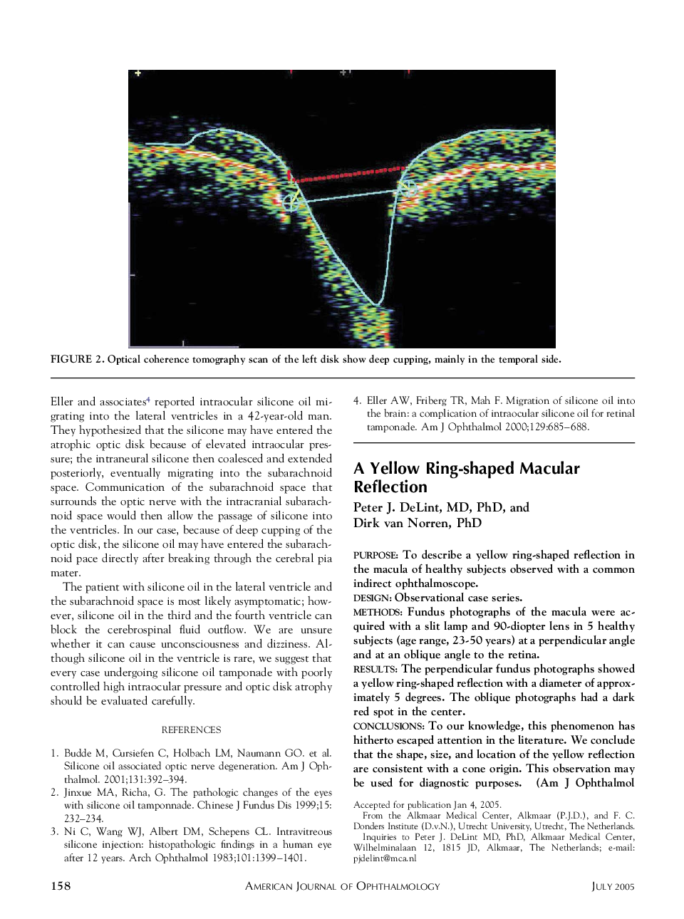 A Yellow Ring-shaped Macular Reflection