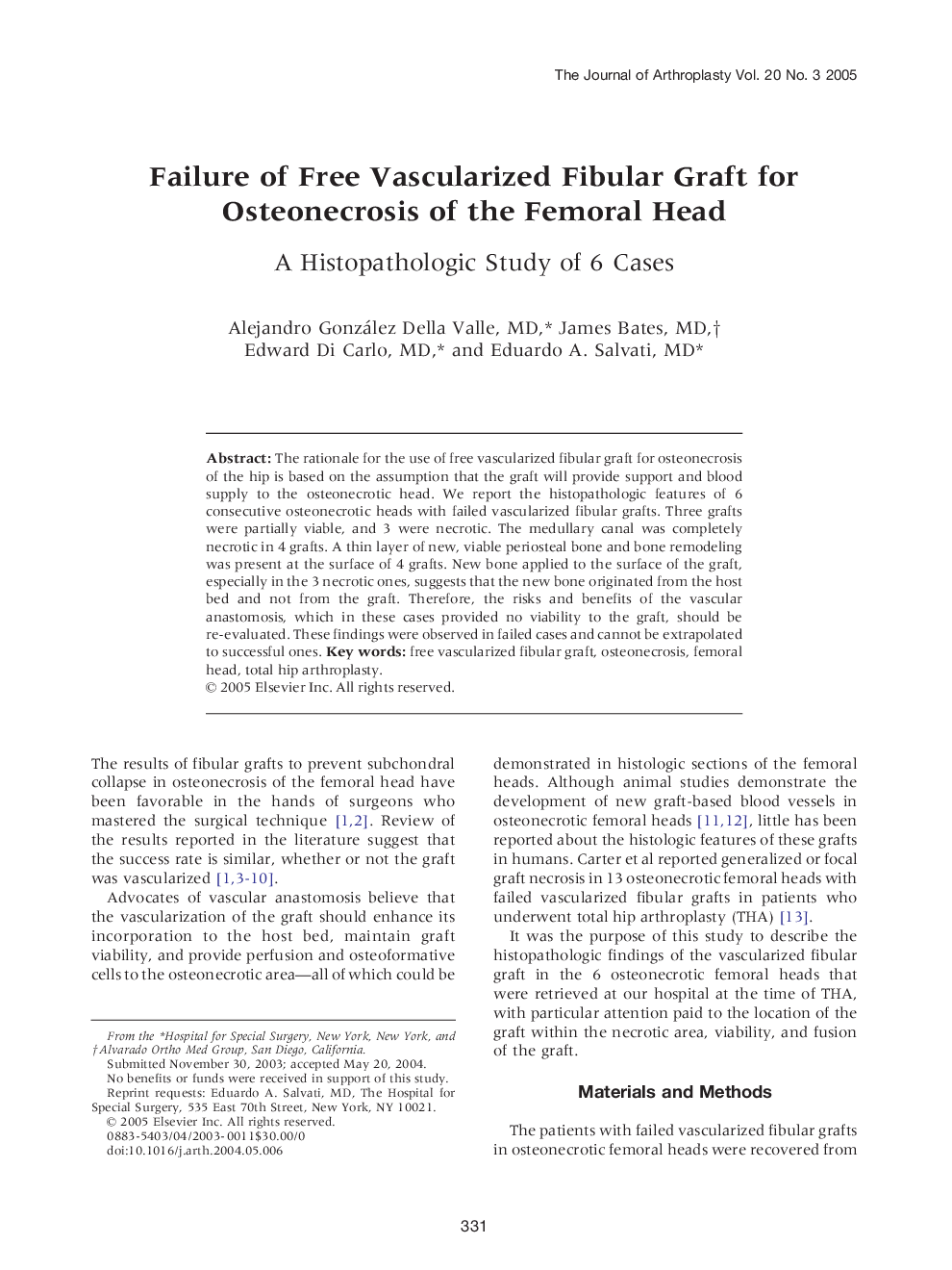 Failure of Free Vascularized Fibular Graft for Osteonecrosis of the Femoral Head