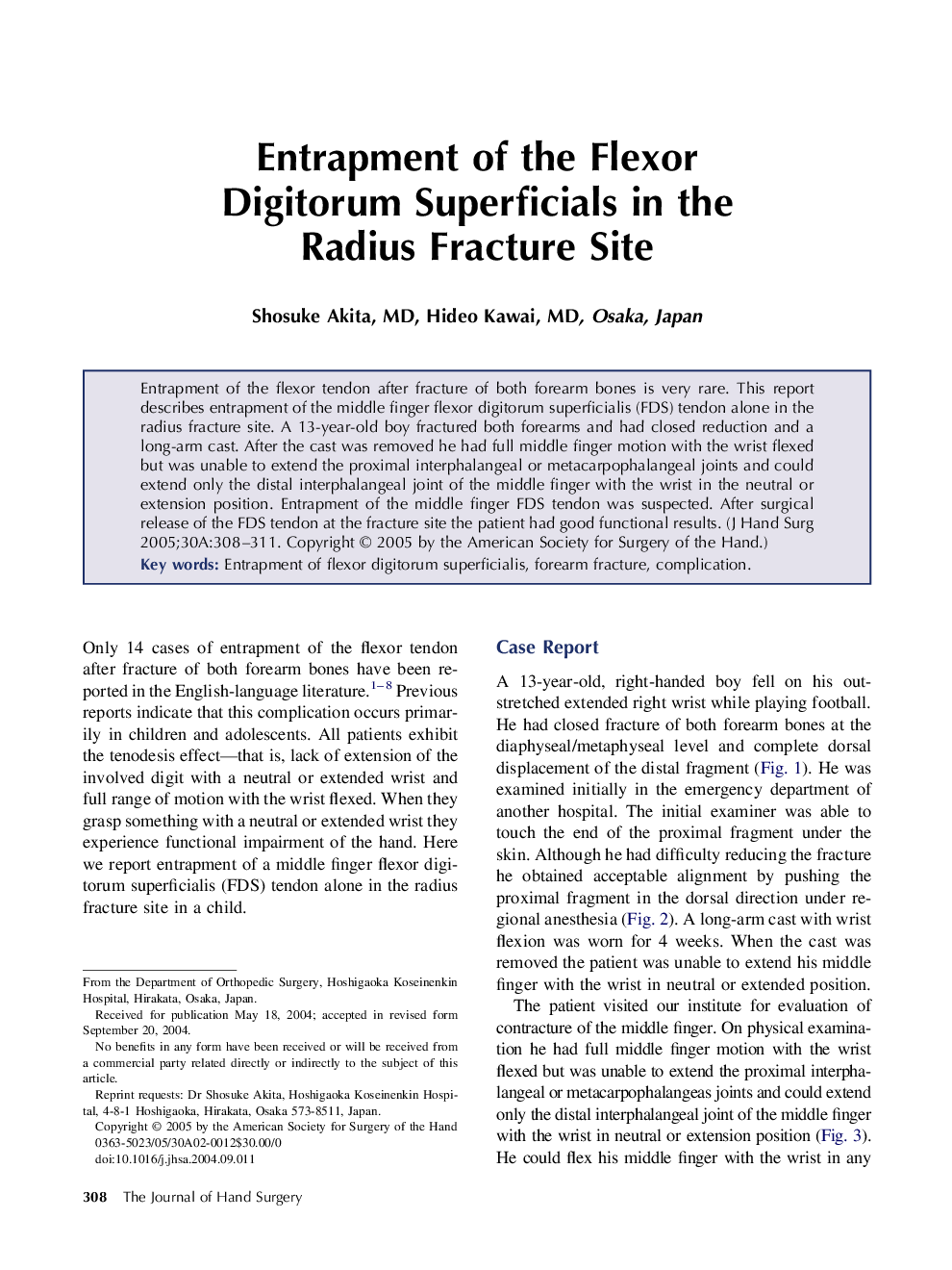 Entrapment of the flexor digitorum superficials in the radius fracture site