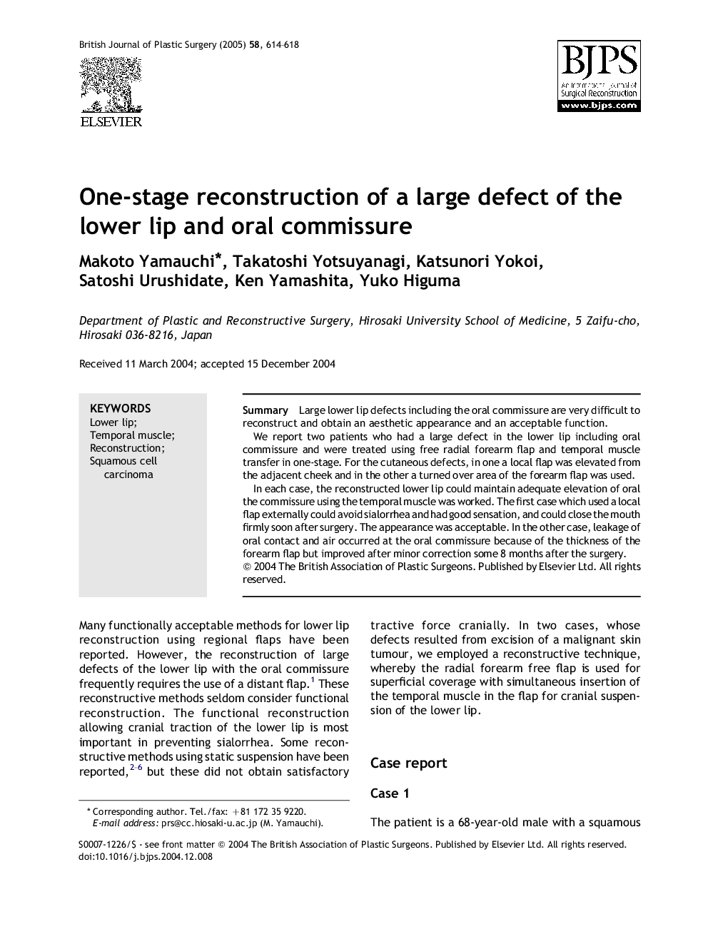 One-stage reconstruction of a large defect of the lower lip and oral commissure
