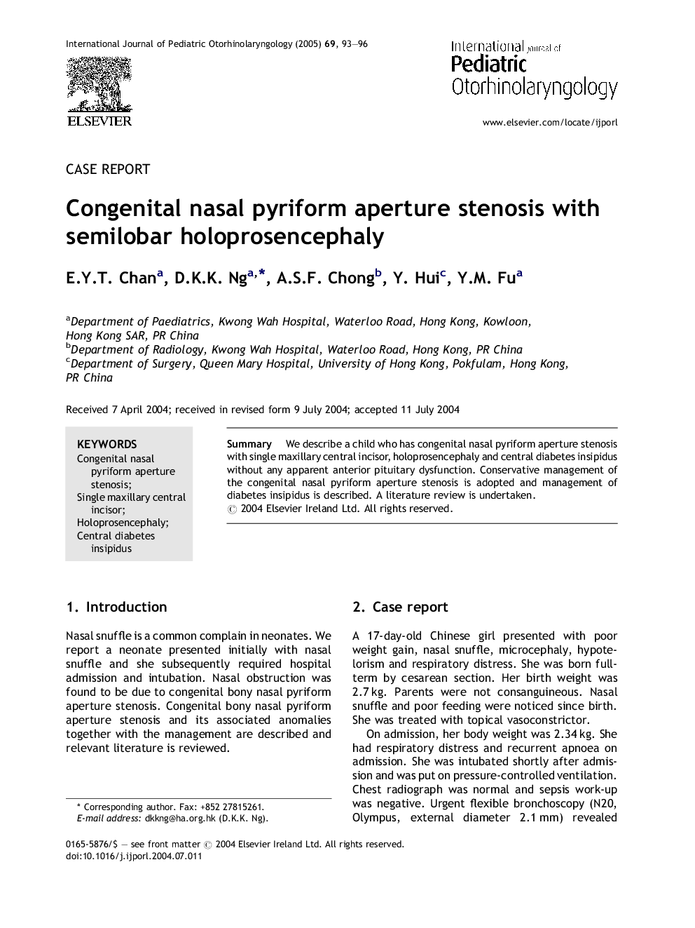 Congenital nasal pyriform aperture stenosis with semilobar holoprosencephaly