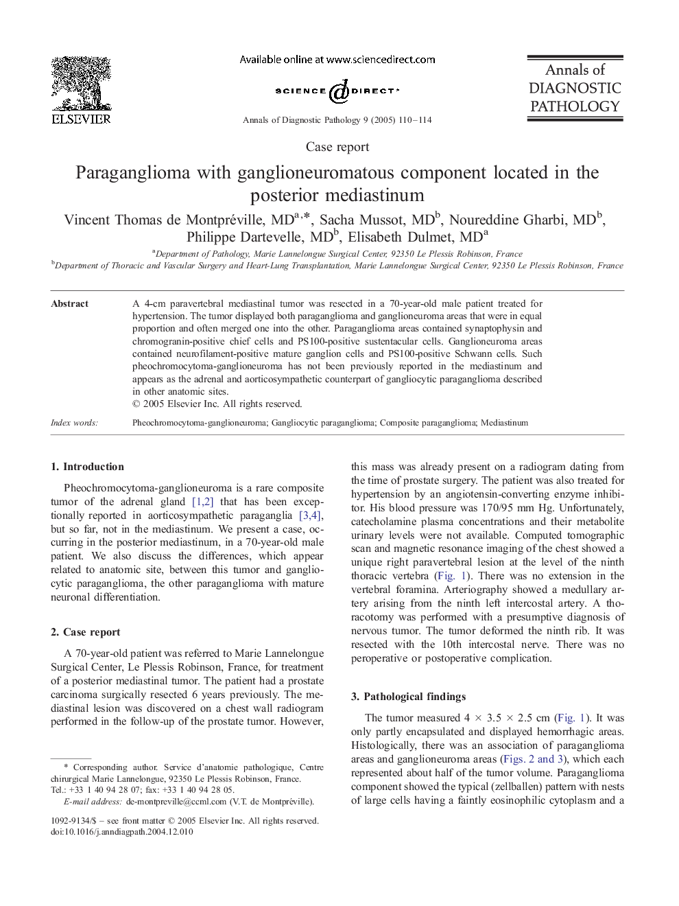 Paraganglioma with ganglioneuromatous component located in the posterior mediastinum