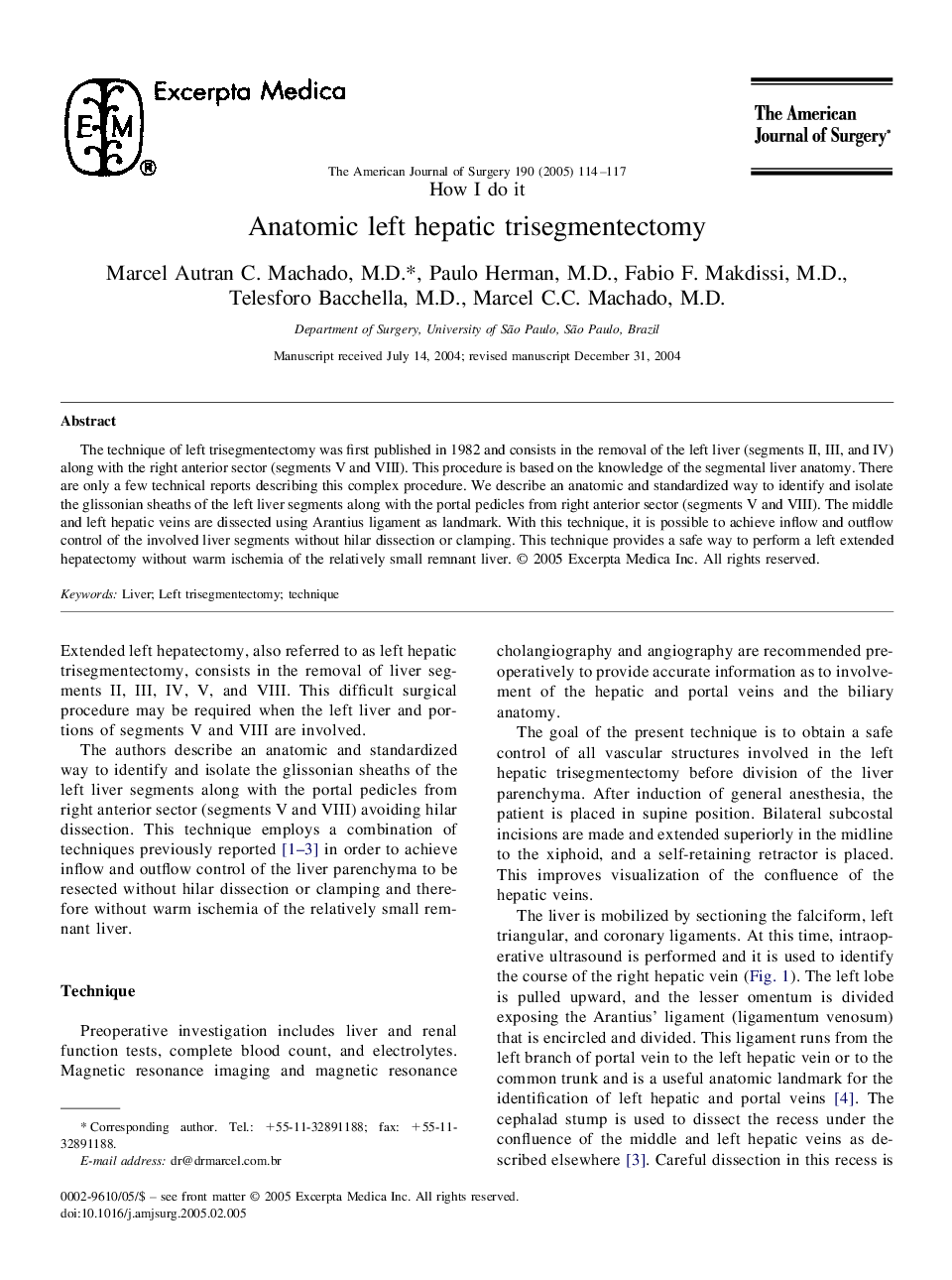 Anatomic left hepatic trisegmentectomy