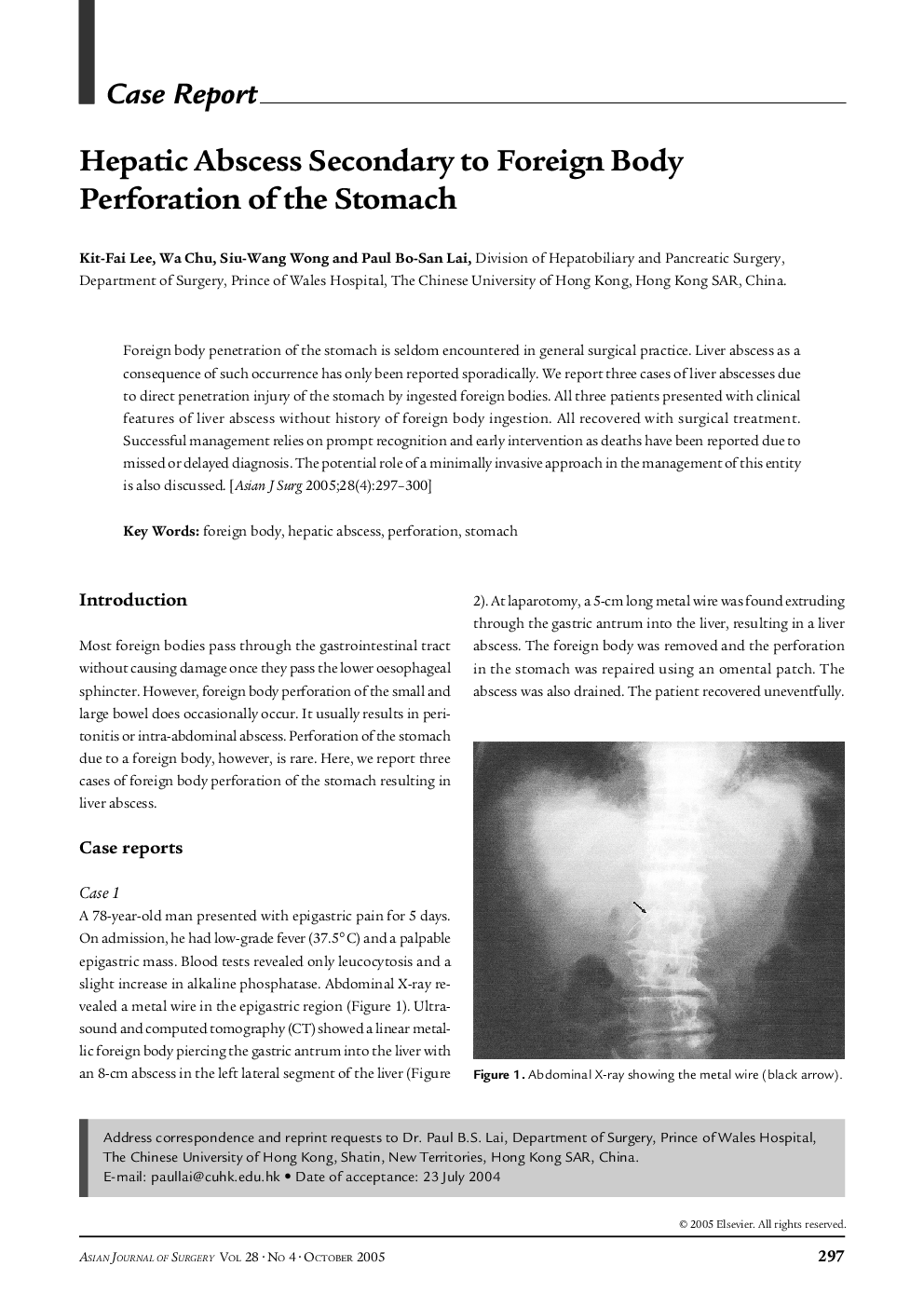 Hepatic Abscess Secondary to Foreign Body Perforation of the Stomach