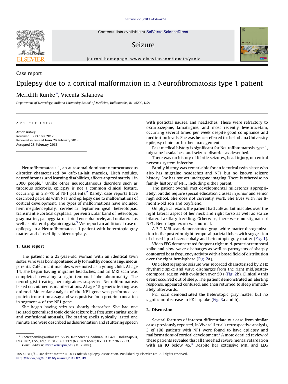 Epilepsy due to a cortical malformation in a Neurofibromatosis type 1 patient