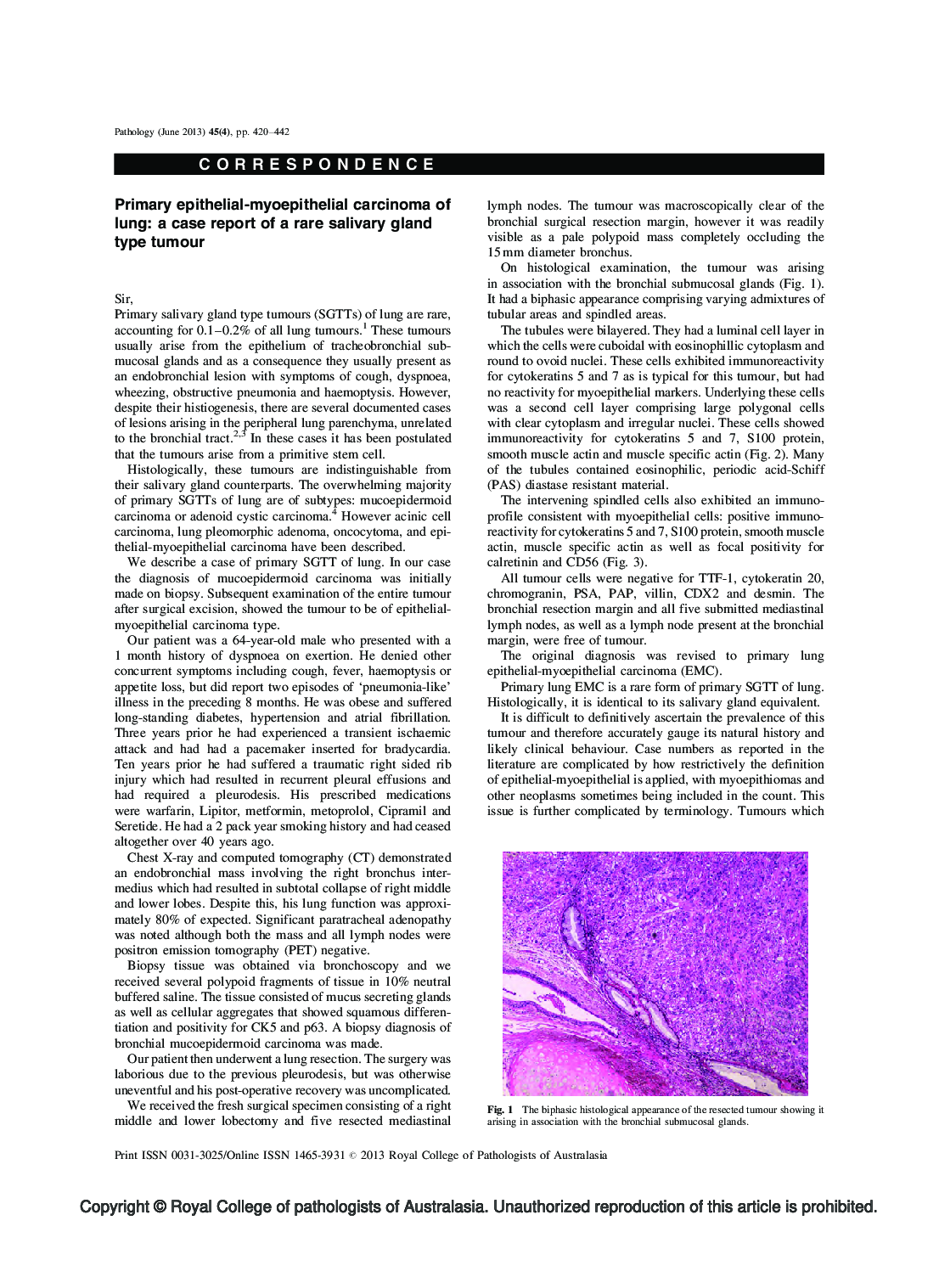 Delayed diagnosis of vaginal leiomyoma following misrepresentative core biopsy