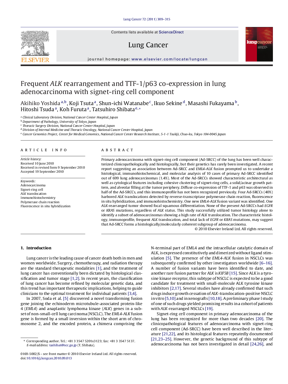 Frequent ALK rearrangement and TTF-1/p63 co-expression in lung adenocarcinoma with signet-ring cell component