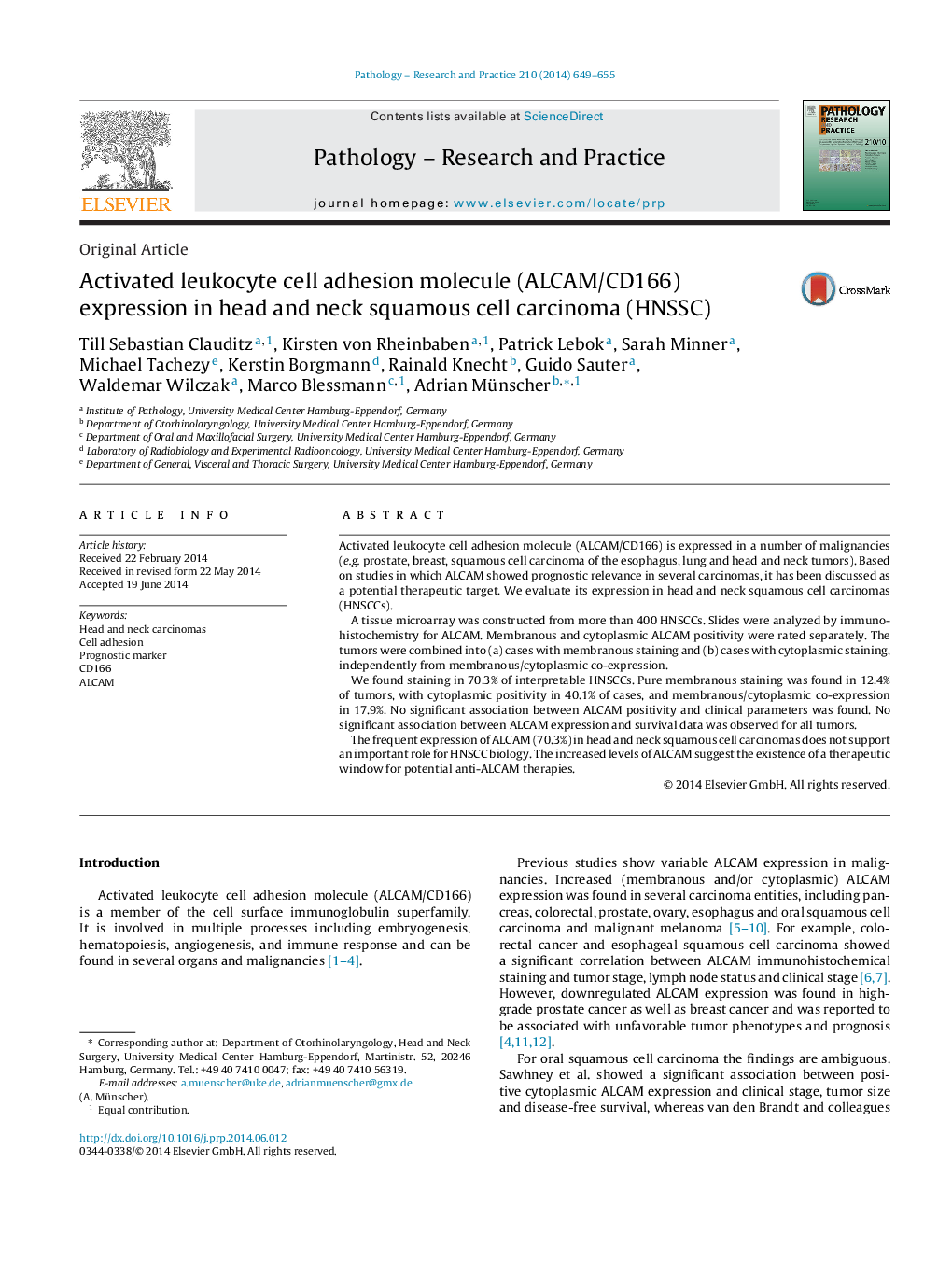 Activated leukocyte cell adhesion molecule (ALCAM/CD166) expression in head and neck squamous cell carcinoma (HNSSC)