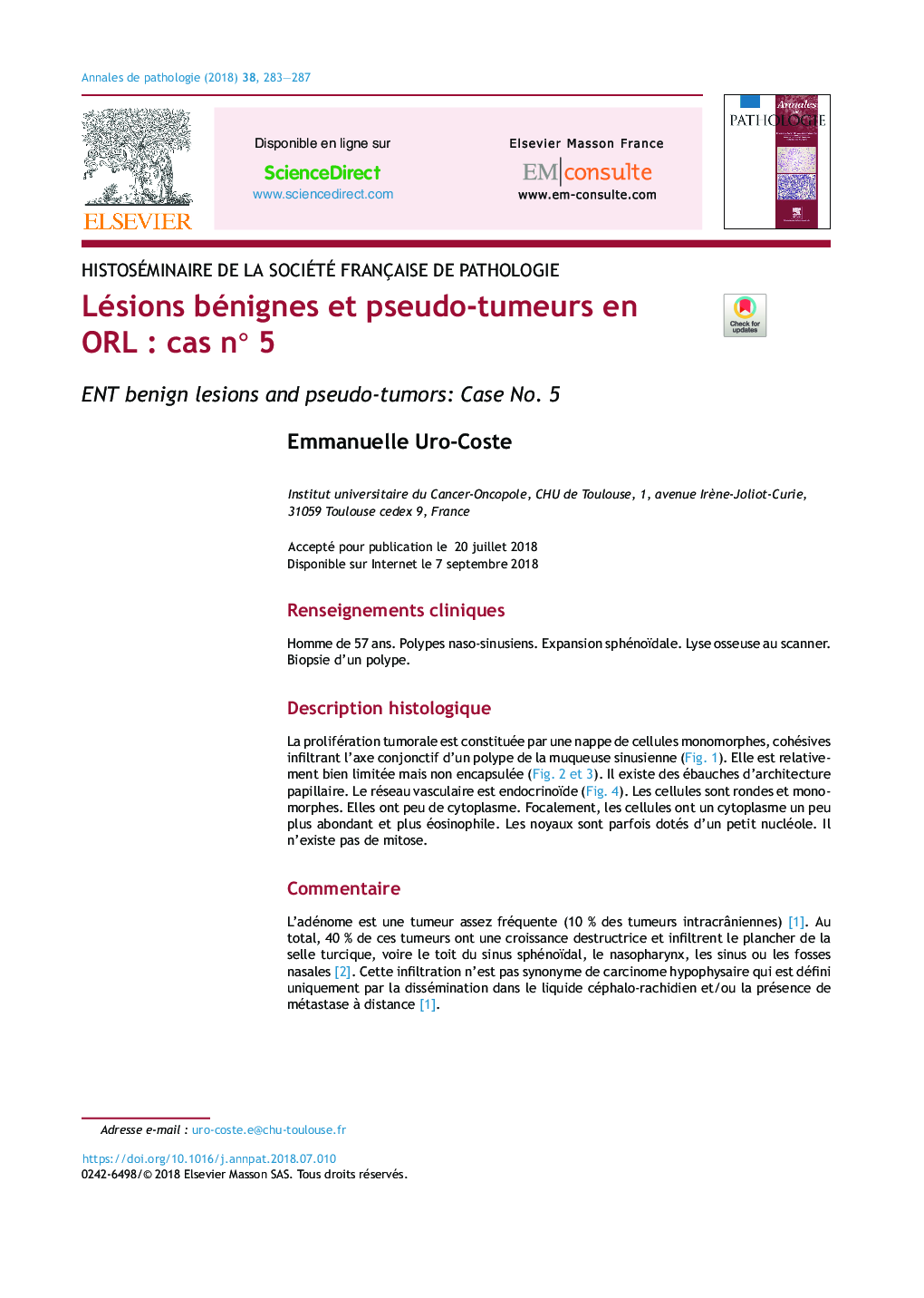 Lésions bénignes et pseudo-tumeurs en ORLÂ : cas nÂ°Â 5