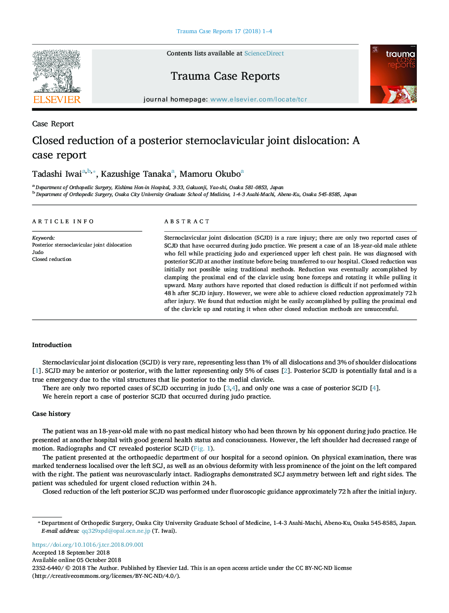 Closed reduction of a posterior sternoclavicular joint dislocation: A case report