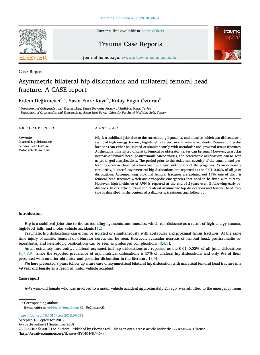 Asymmetric bilateral hip dislocations and unilateral femoral head fracture: A CASE report