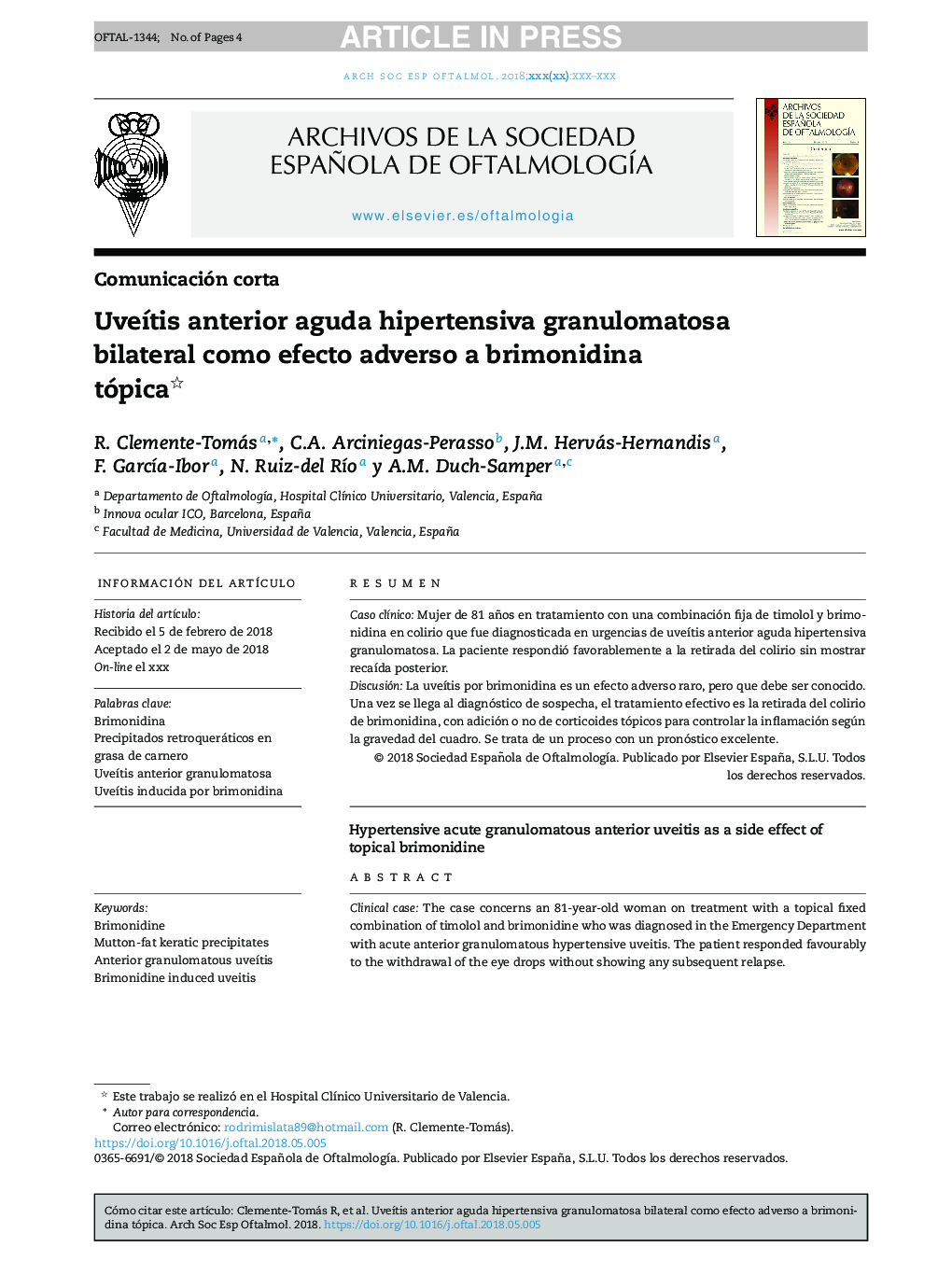 UveÃ­tis anterior aguda hipertensiva granulomatosa bilateral como efecto adverso a brimonidina tópica