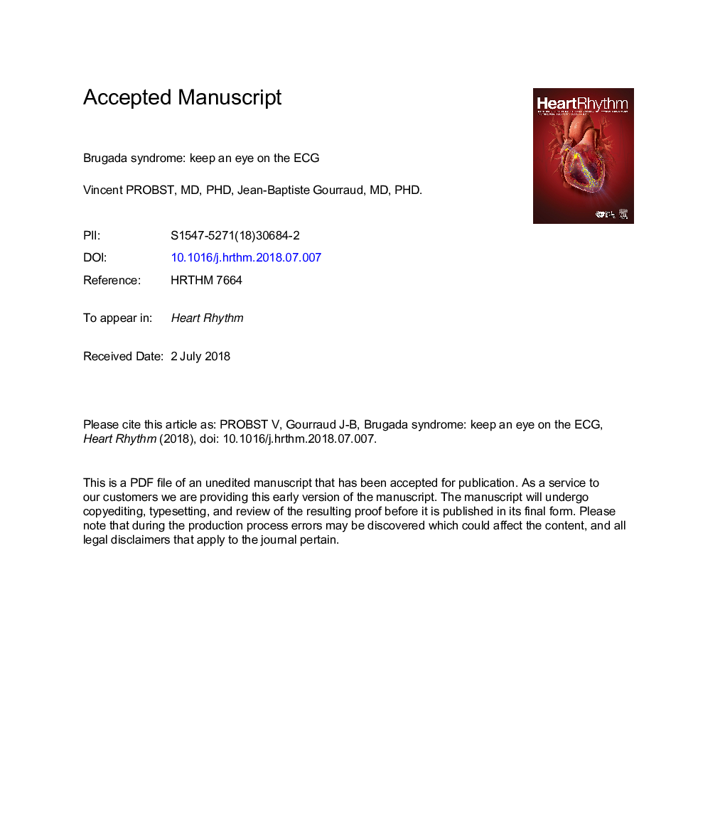 Brugada syndrome: Keep an eye on the electrocardiogram