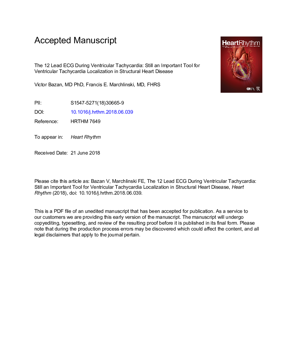 The 12-lead ECG during ventricular tachycardia: Still an important tool for ventricular tachycardia localization in structural heart disease