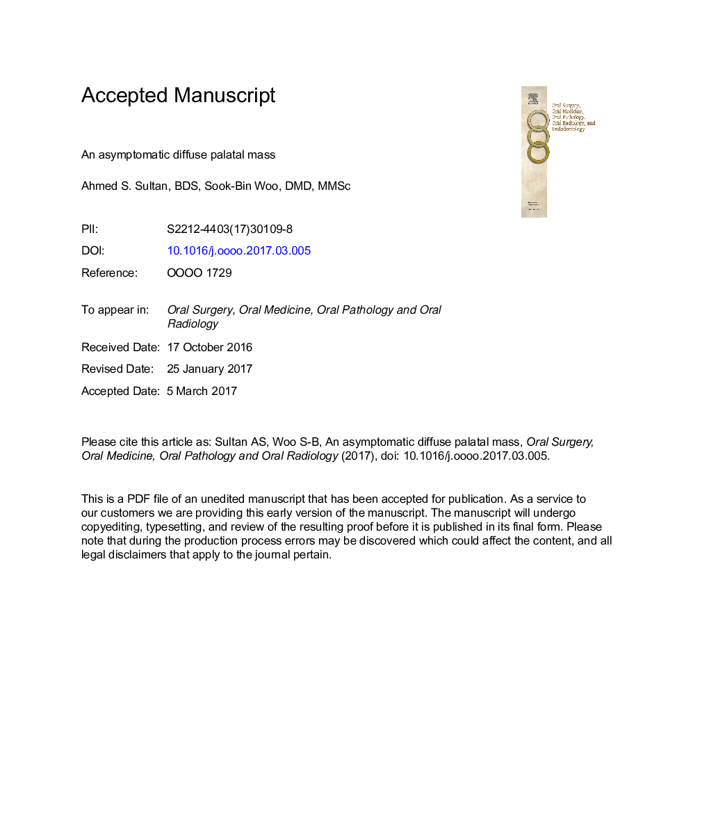 An asymptomatic diffuse palatal mass