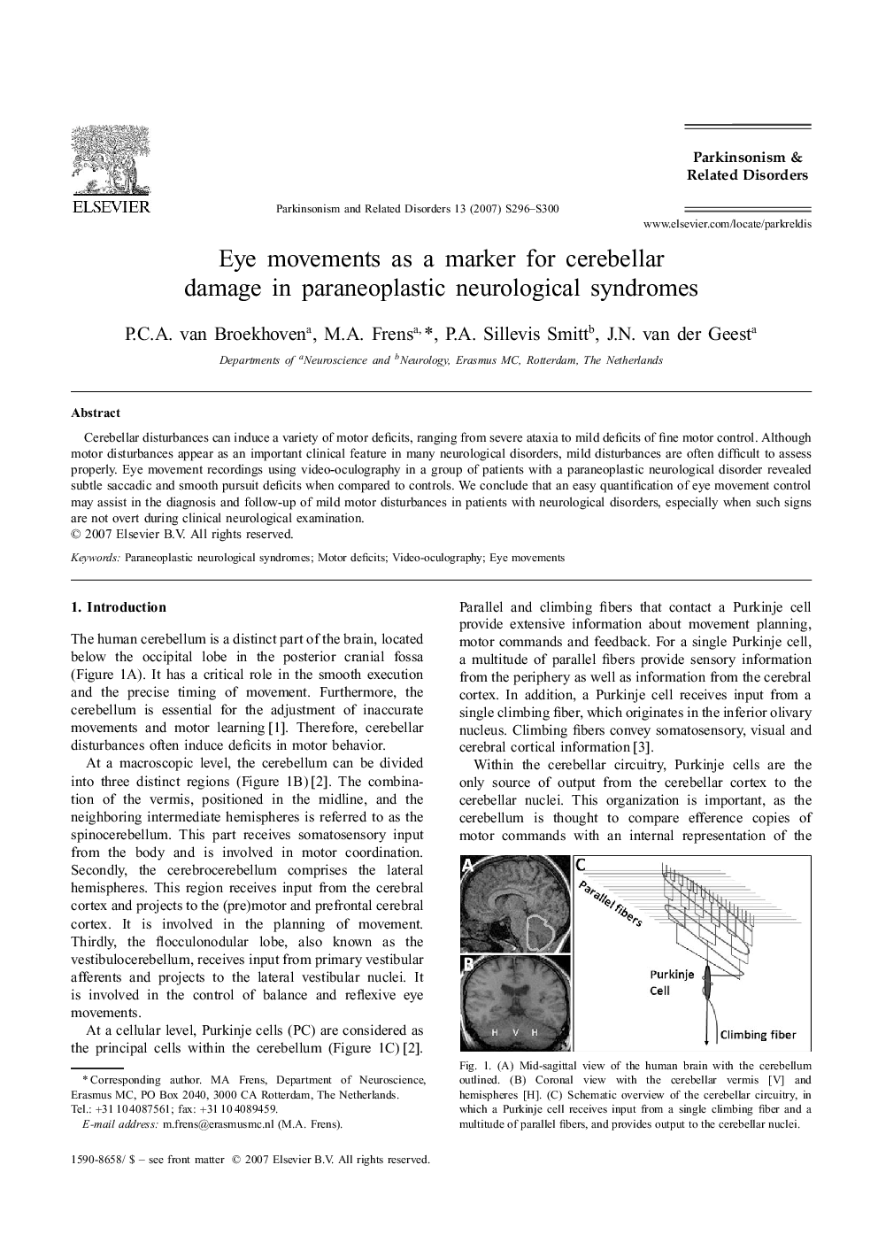 Eye movements as a marker for cerebellar damage in paraneoplastic neurological syndromes