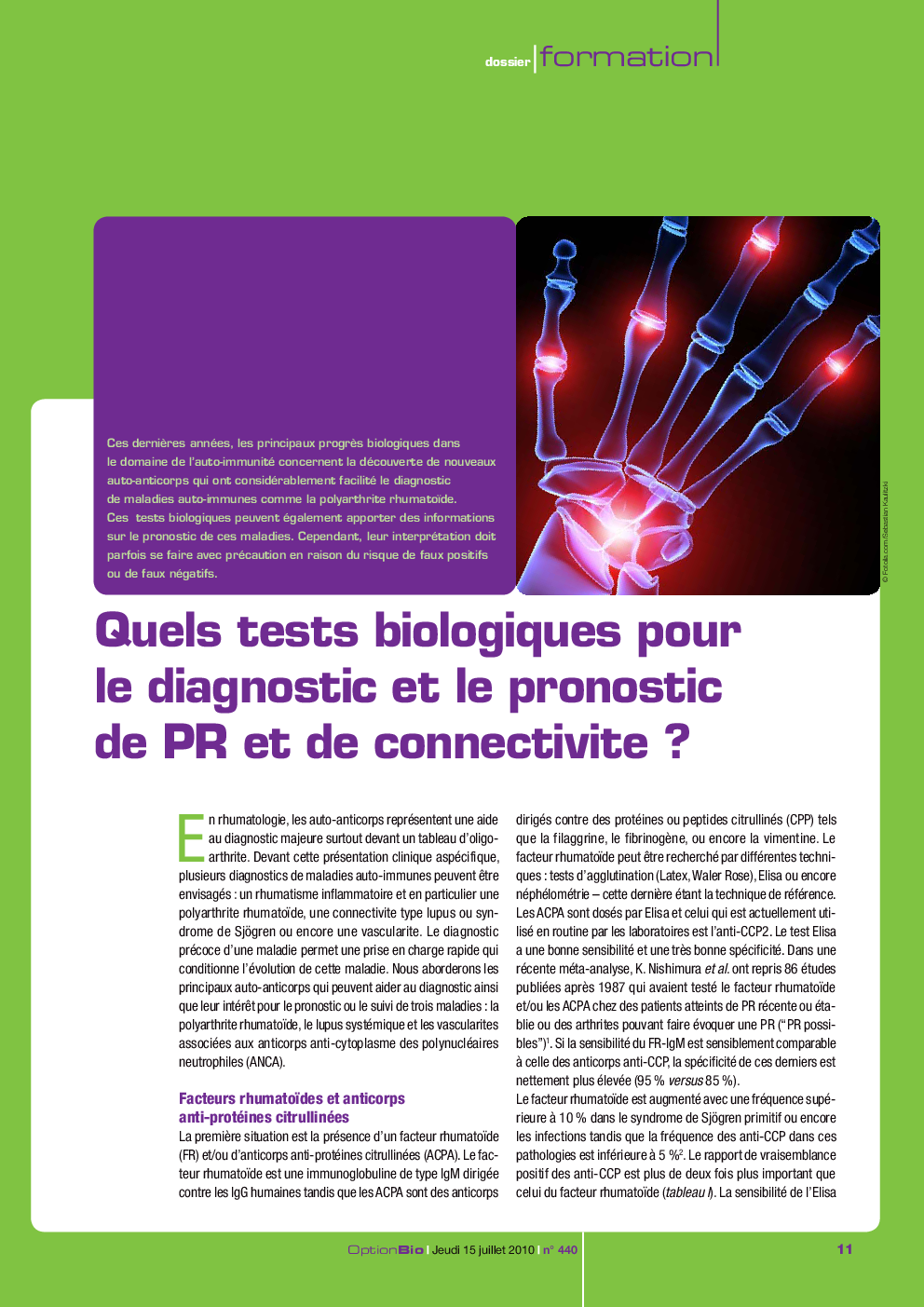 Quels tests biologiques pour le diagnostic et le pronostic de PR et de connectivite ?