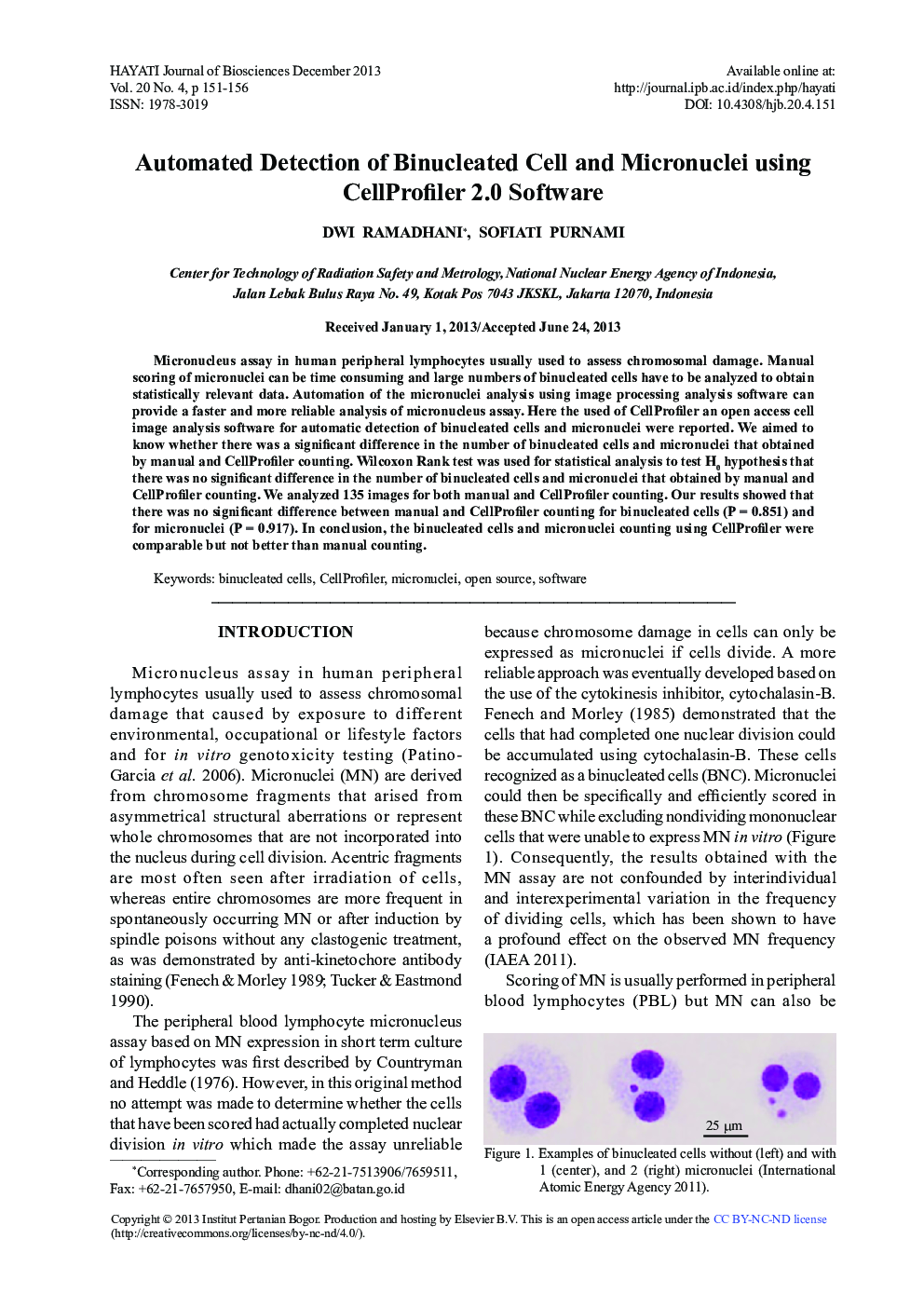 Automated Detection of Binucleated Cell and Micronuclei using CellProfiler 2.0 Software