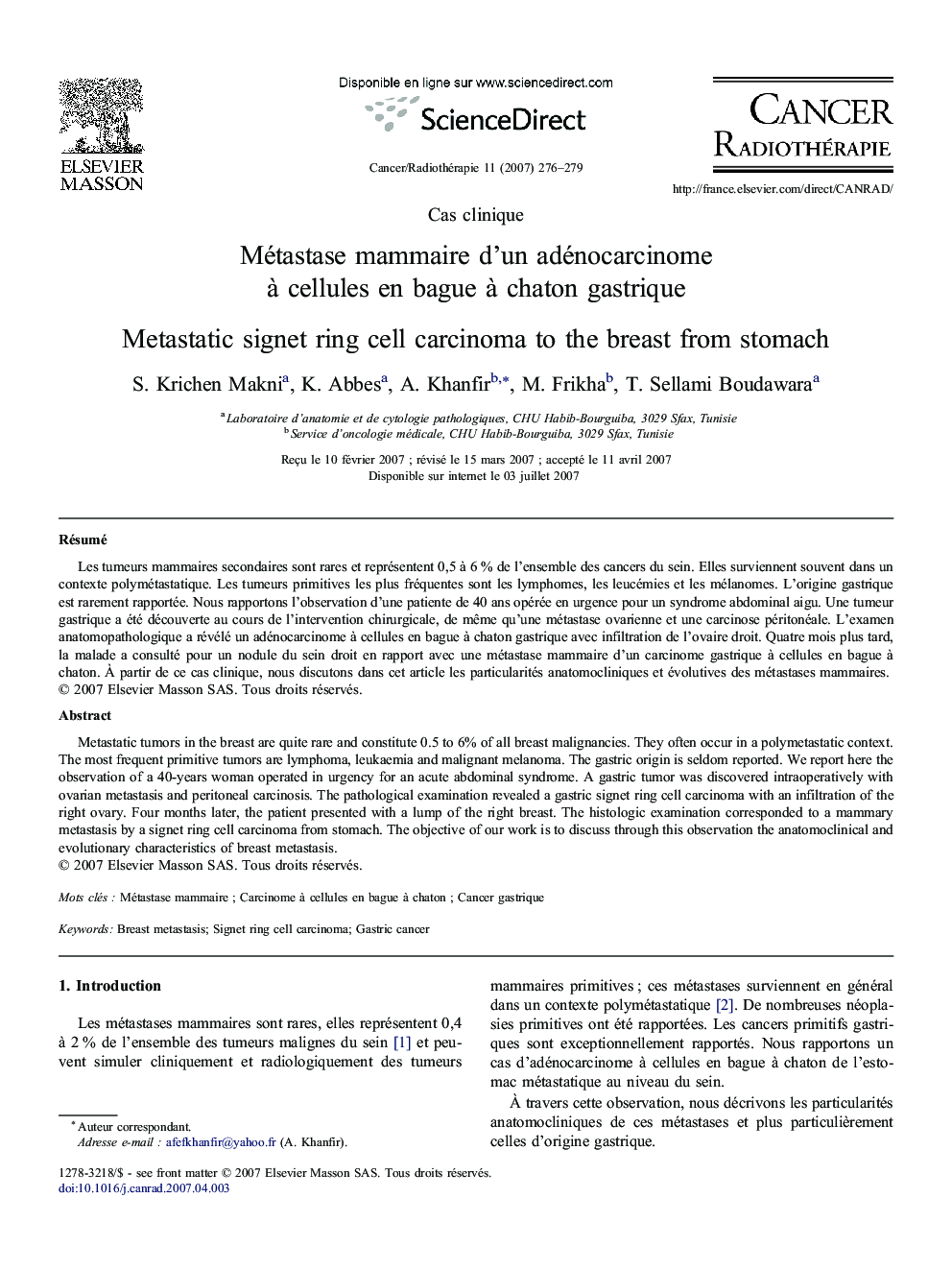 Métastase mammaire d'un adénocarcinome à cellules en bague à chaton gastrique
