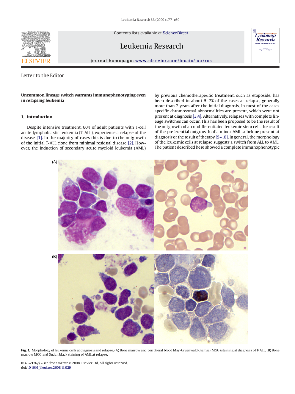 Uncommon lineage switch warrants immunophenotyping even in relapsing leukemia