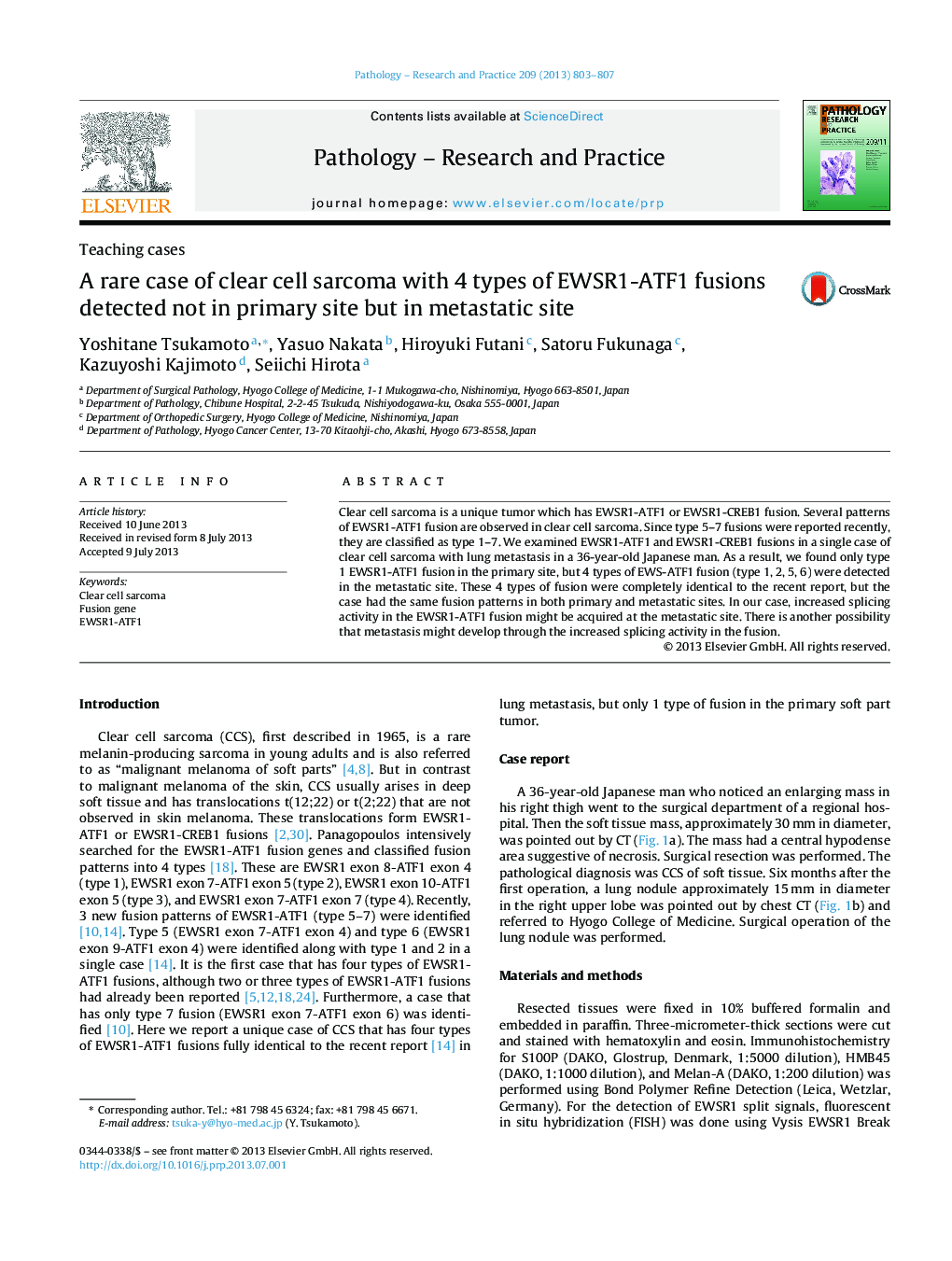 A rare case of clear cell sarcoma with 4 types of EWSR1-ATF1 fusions detected not in primary site but in metastatic site