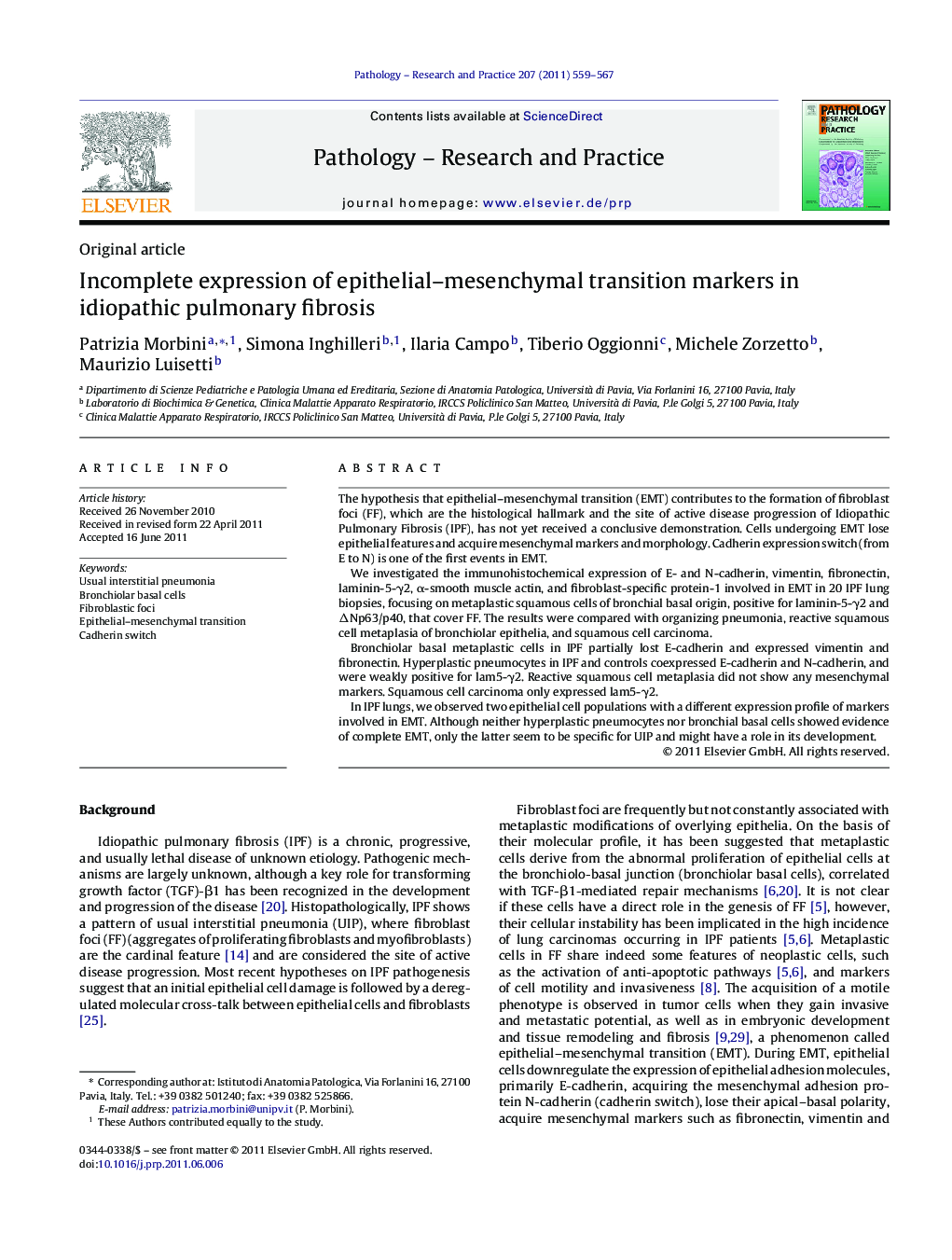 Incomplete expression of epithelial–mesenchymal transition markers in idiopathic pulmonary fibrosis