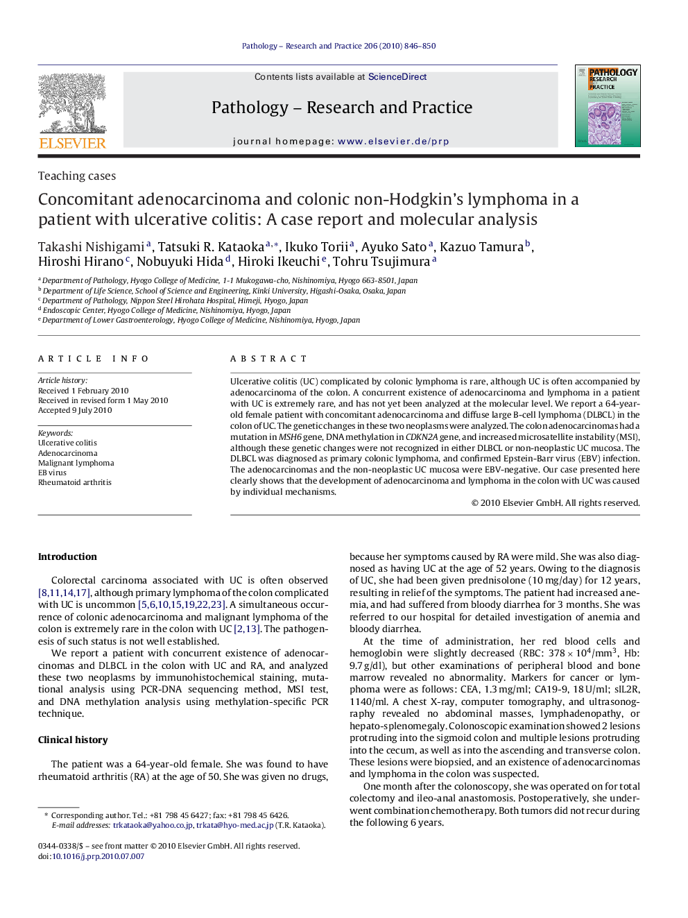 Concomitant adenocarcinoma and colonic non-Hodgkin's lymphoma in a patient with ulcerative colitis: A case report and molecular analysis