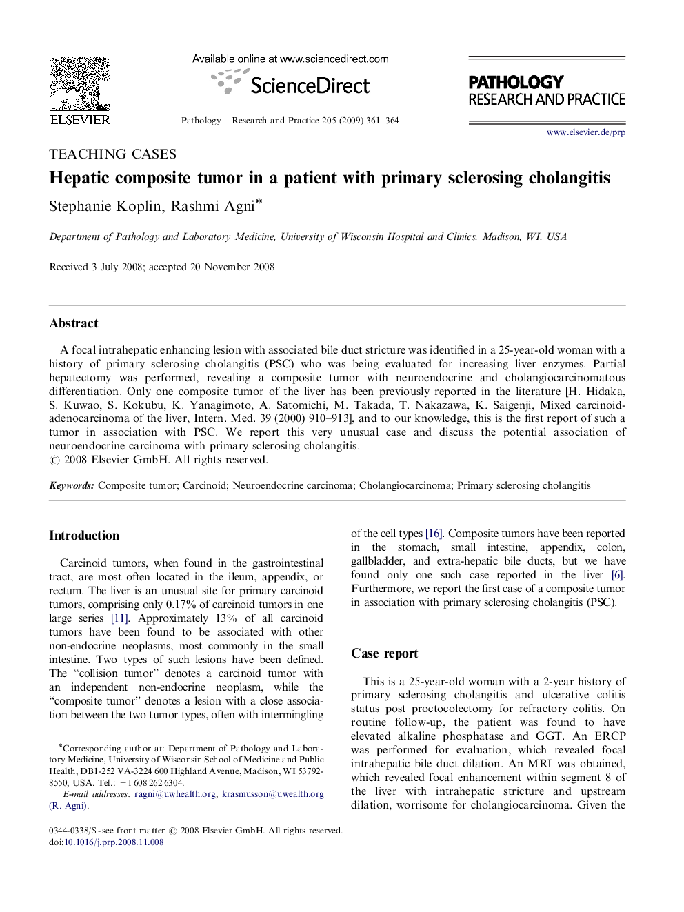 Hepatic composite tumor in a patient with primary sclerosing cholangitis