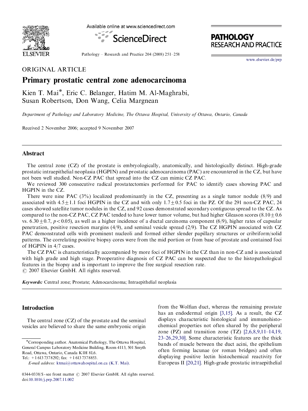 Primary prostatic central zone adenocarcinoma