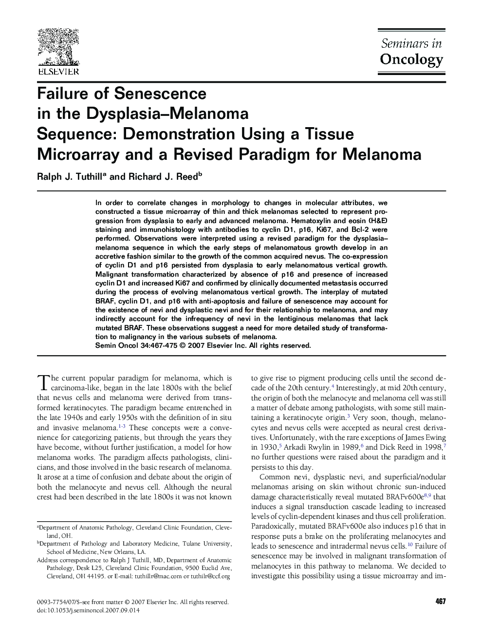 Failure of Senescence in the Dysplasia-Melanoma Sequence: Demonstration Using a Tissue Microarray and a Revised Paradigm for Melanoma