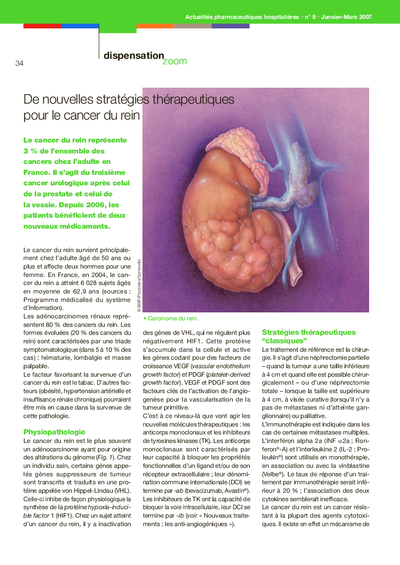 De nouvelles stratégies thérapeutiques pour le cancer du rein