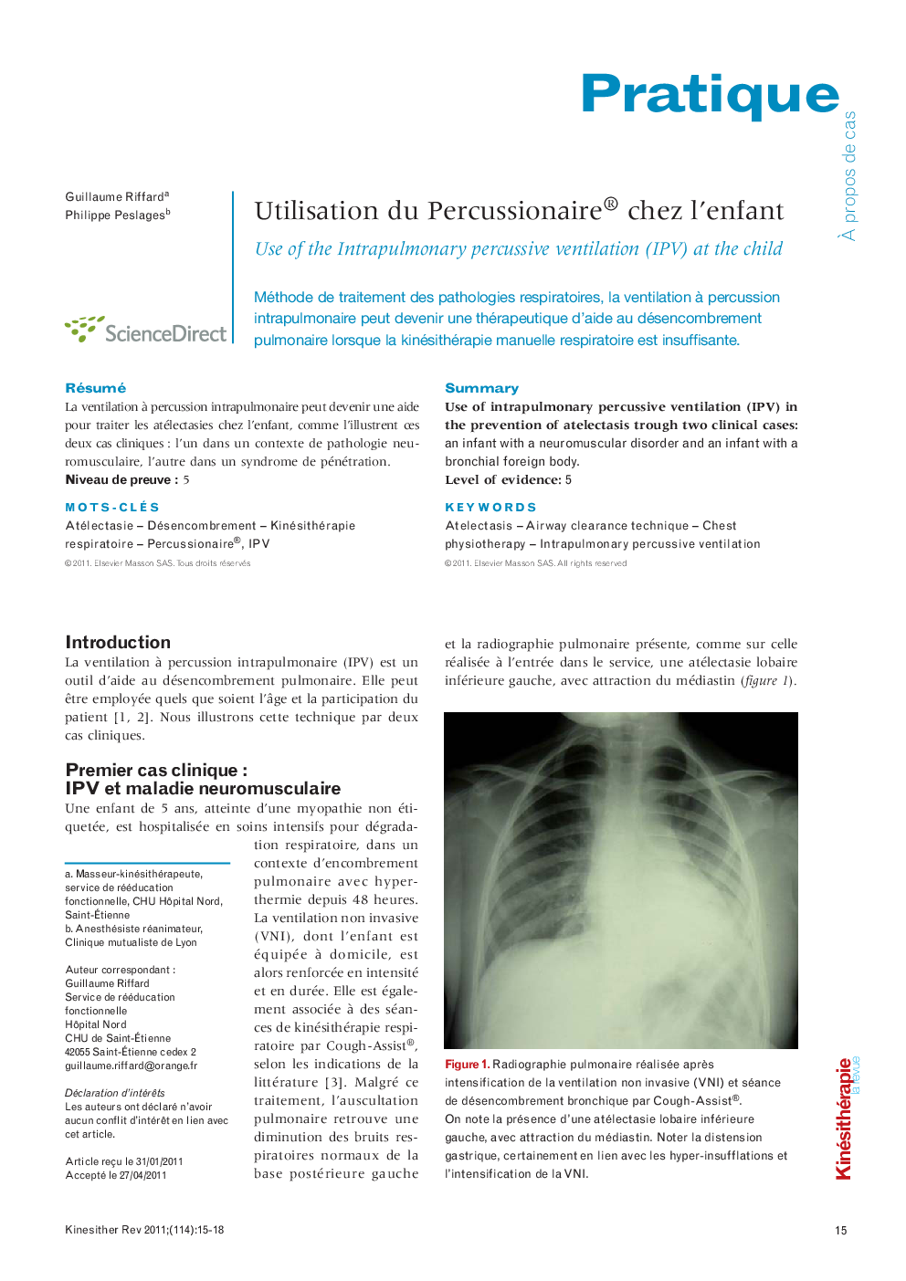  Utilisation du Percussionaire® chez l’enfant : Use of the Intrapulmonary percussive ventilation (IPV) at the child