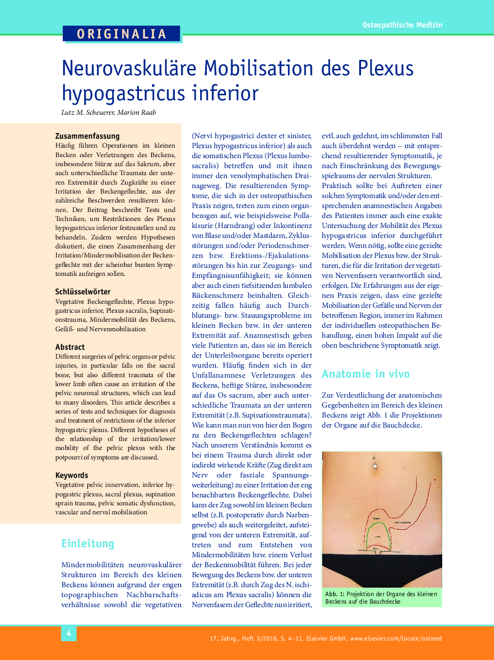 Neurovaskuläre Mobilisation des Plexus hypogastricus inferior
